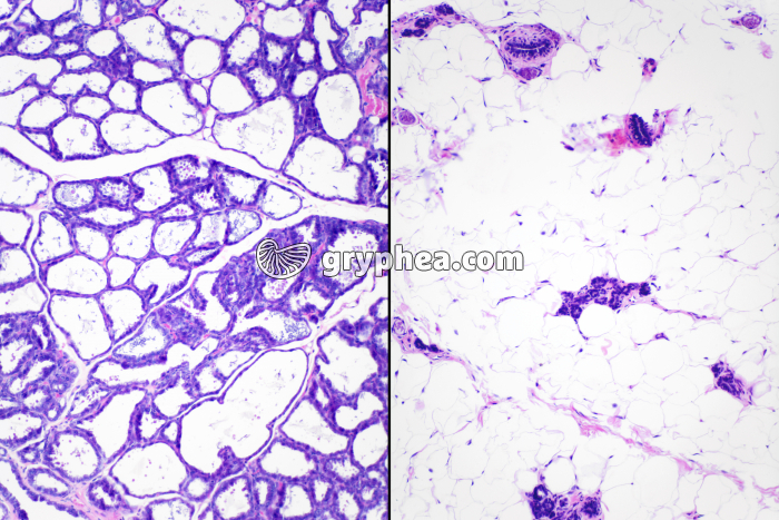 Glande mammaire activité et repos x40 - gryphea.com